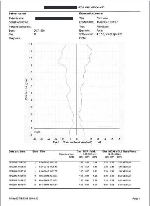 Figure 2 - Work sheet with the  acoustic rhinometry results.