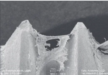 Figure 1 - The titanium surface topography (50 X). Figure 2 - SEM - 24 hours - Cell adhesion to the machined  dental implant (100 X).