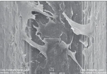 Figure 4  -  SEM  -  72 hours  -  Cells  with  large  flat  bodies,  spread over the machined titanium surface (400 X).