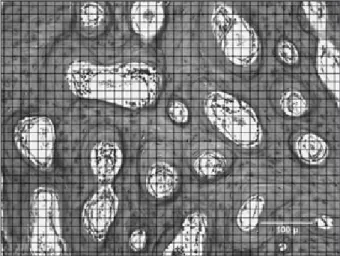 Figure 2 - 1,200-point grid positioned onto each digitized  image of a histological section