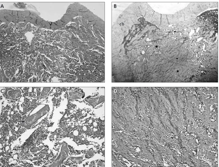 Figure 2 - Photomicrographs illustrating transversal sections of the tibia without defect for SHR (A/C) and NTR (B/D) groups,  showing low proportions of bone trabeculae and large inter-trabecular spaces in the medullar area of the SHR group