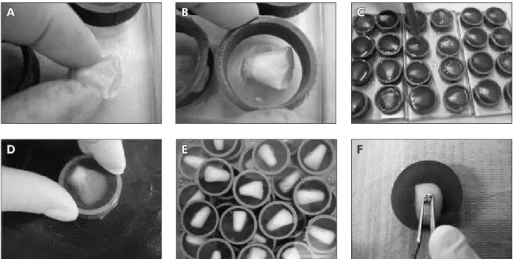 Figure 1 - Sample preparation. (A) Positioning of buccal surface of bovine incisors facing the glass plate; (B) Insertion of ap- ap-paratus support; (C) Submersion in epoxy resin; (D) Bond area exposure; (E) Washing of the samples; (F) Bonding of incisor  