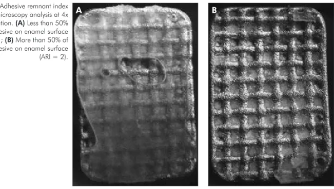 Figure 2 - Adhesive remnant index  optical microscopy analysis at 4x  magnification. (A) Less than 50% 