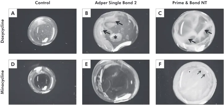 Figure 2 - Representative digital pictures of the MI and DO solutions (A and D) and the solution homogeneity after mixing  these solutions with the adhesive systems