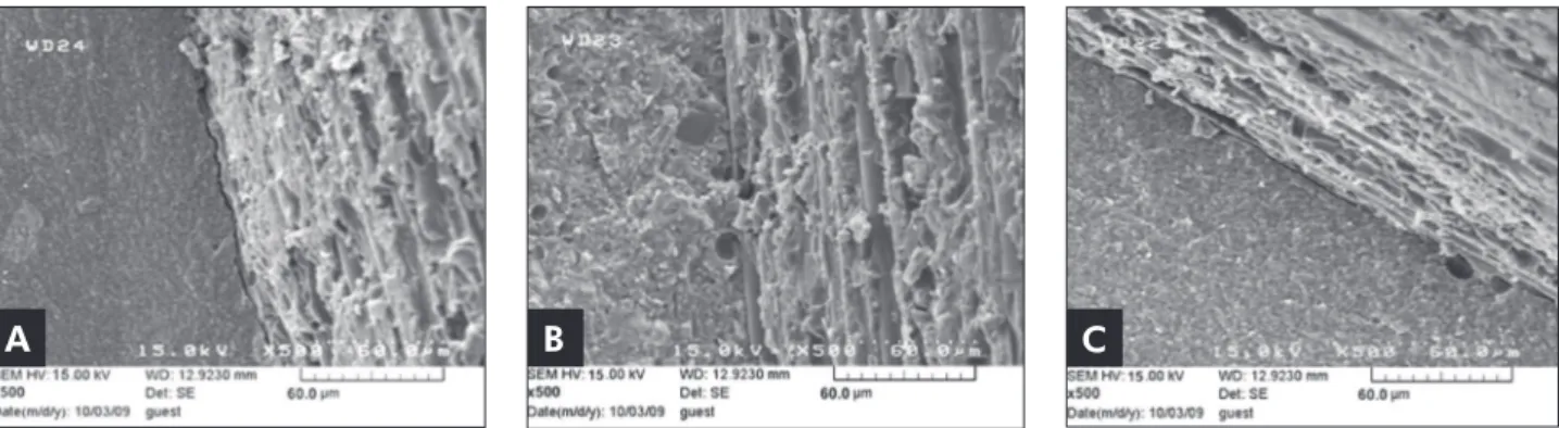 Figure 4 - SEM micrographs showing the better adaptation of Alite (A) and Z250 (C) to the post surface than Biscore (B) (The  right side of each micrograph is the post and the left side is the composite resin).