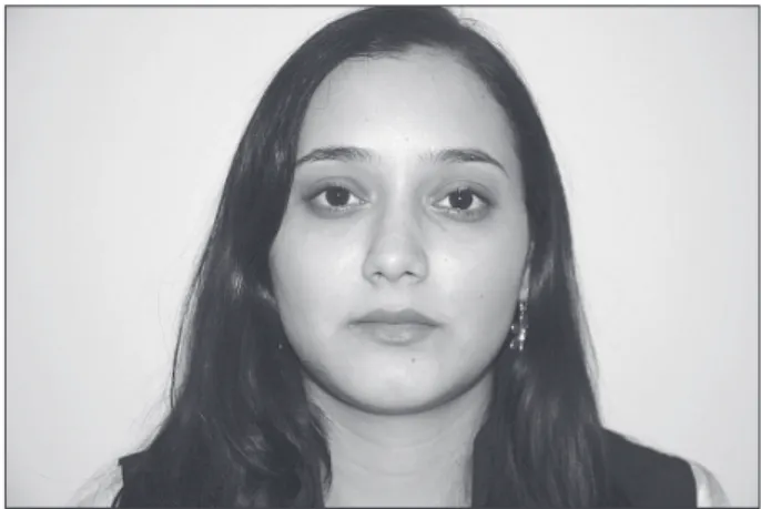 Figure 1 - Front view of the face with the patient at rest.
