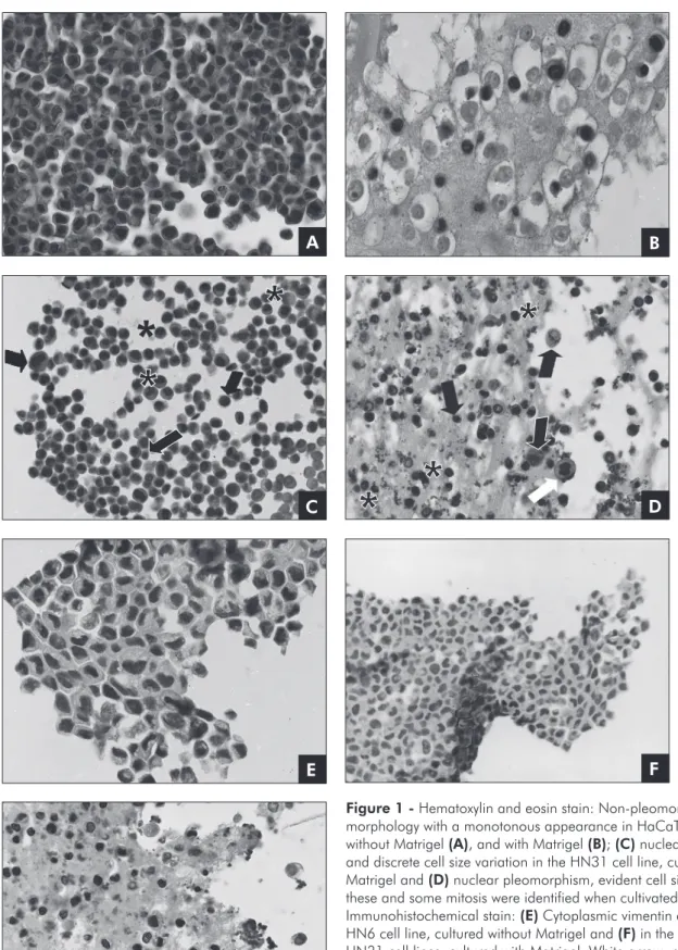 Figure 1 - Hematoxylin and eosin stain: Non-pleomorphic cell  morphology with a monotonous appearance in HaCaT cell line cultured  without Matrigel (A), and with Matrigel (B); (C) nuclear pleomorphism  and discrete cell size variation in the HN31 cell line