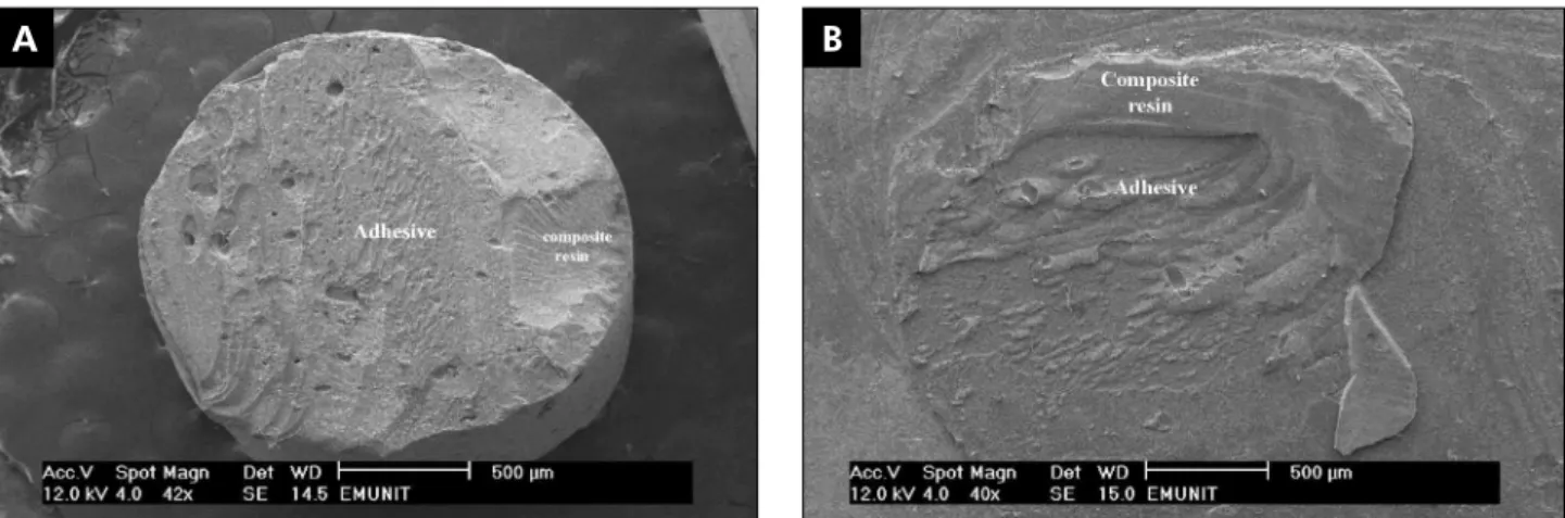 Figure 1 - SEM photomicrographs indicating cohesive failure within both the adhesive and the composite resin