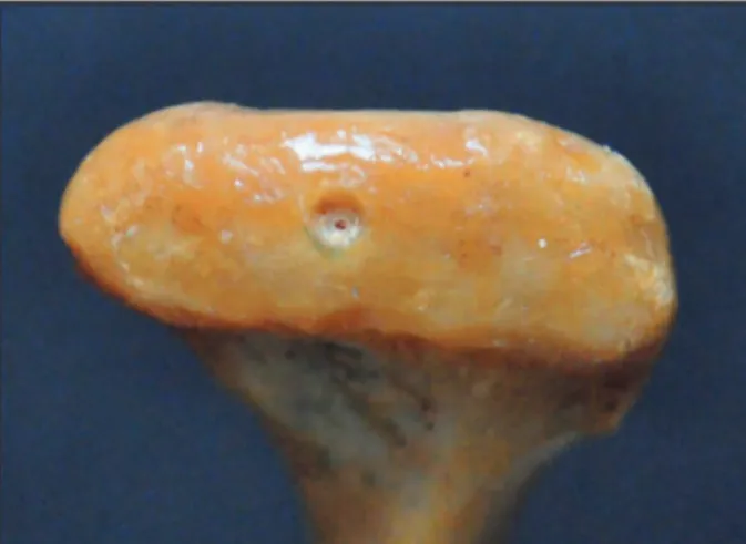 Figure 1 - Example of a medium defect created in the su- su-perior surface of the condyle.