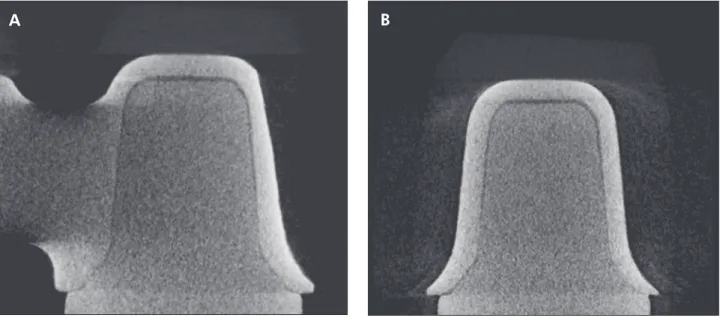 Figure 2 - Cross-sectional images through the center of the die (x-axis), in the mesiodistal (A) and buccolingual directions (B).