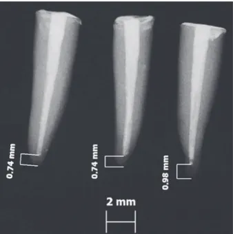 Figure 1 - Obturation limits analysis by AxioVision 4.5 soft- soft-ware (Carl Zeiss Vision, Hallbergmoos, Germany).