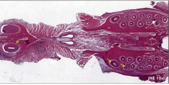 Figure 2. Section evidencing the mesiobuccal and intermediate roots (yellow arrows) and maxillary right incisor with dentoalveolar ankylosis  (green arrow)