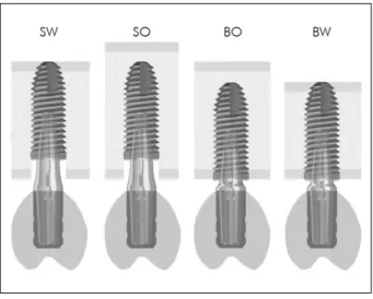 Figure 1. Using a 1-mm-thick cortical layer and different  trabecular bone heights, four models are created using one  4.0 × 11-mm implant with platform switching and internal  Morse taper connection