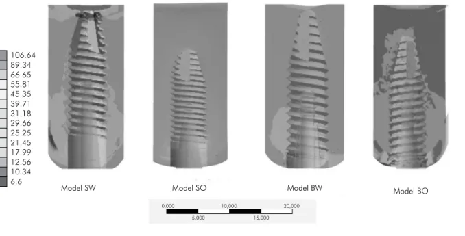 Figure 2. Compressive stress (MPa) around implants with different anchorage designs under centric loading.
