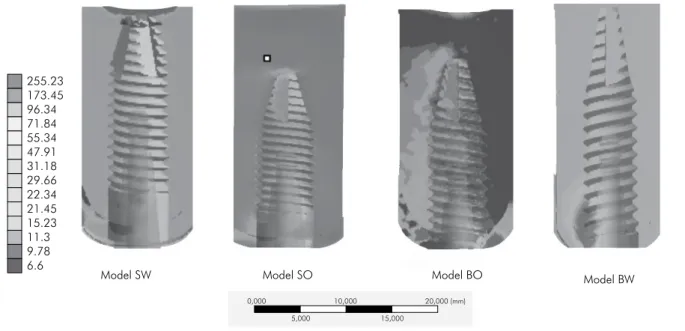 Figure 3. Compressive stress (MPa) around implants with different anchorage designs under eccentric loading.