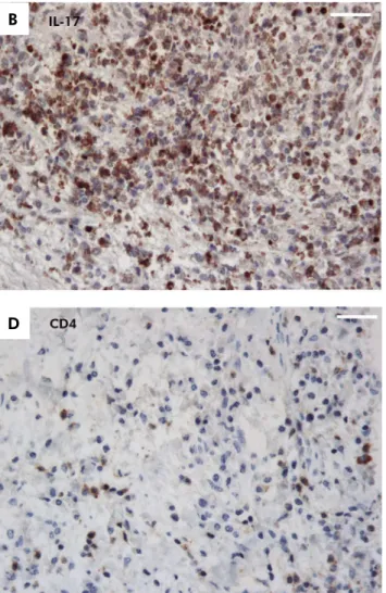 Figure 1. Immunohistochemical labeling of elastase, IL-17A, CD4, and CD8 for periapical abscesses (Streptavidin-biotin, 400 ×  original magnification, bar 50 μm) (A) Intense immunolabeling of elastase in polymorphonucleated cells