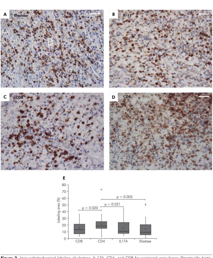 Figure 2. Immunohistochemical labeling of elastase, IL-17A, CD4, and CD8 for periapical granulomas (Streptavidin-biotin,  400 × original magnification, bar 50 μm) (A) Intense IL-17A immunolabeling in polymorphonucleated cells