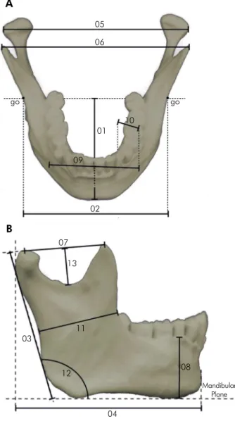 Figure 3. Mandible measurements. 1. maximum mandibular  length; 2. bigonial width; 3. maximum ramus height, right and  left; 4