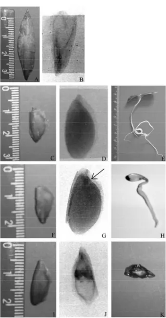 Figura  2  –  Sementes  de  Cedrela  fissilis  visualmente intactas (a, c, f e i), classificadas pela análise radiográfica em Semente Vazia (b), Semente Cheia (d) Semente com Danos (g) e Semente Mal Formada (j); originando plântula normal (e), plântula ano