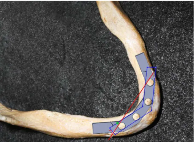 Figure 2. Sequence to bar confection: A) Jaw shaped B) Analogue distribution C) Bone impression D) Plaster cure.