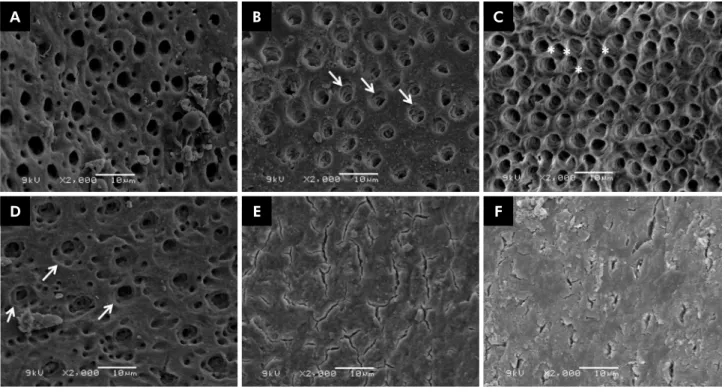 Figure 2. SEM images (2000×) illustrating the effects caused by irrigation protocols on the inorganic component of dentin