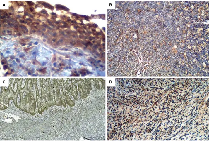 Figure 1. Representative photomicrographs of immunohistochemical staining of the studied markers in periapical lesions