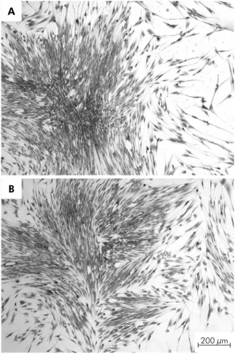 Figure 1. Illustrative phase micrographs of dental pulp  cells presenting colony-forming activity stained with Giemsa