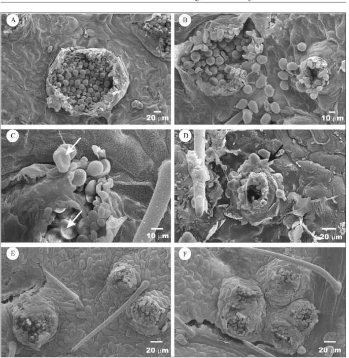 FIGURA 3   Eletromicrografias de varreduras de folhas de soja infectadas com Phakopsora pachyrhizi, submetida à aplicação de diversos óleos essenciais