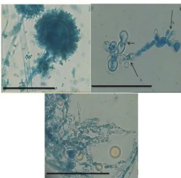 FIGURE 4 - Light microphotographs of A. flavus LM-02  mycelium growing on AS with or without O