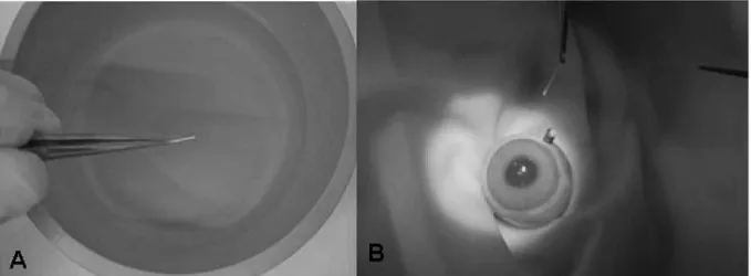 FIGURE 2  - Photography of the biodegradable device that does not require surgical procedure before (A) and after (B) implantation