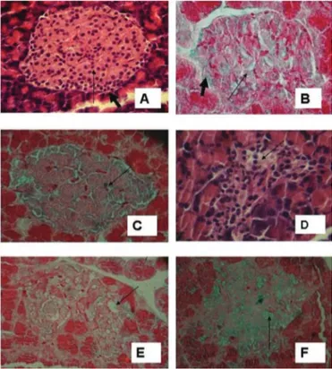 FIGURE 2 -  Photomicrographs (400X) showing effects  of different treatments on histopathological parameters of  pancreatic islets
