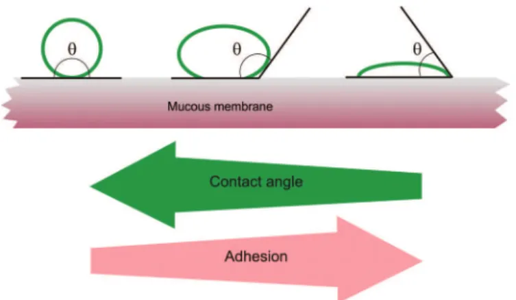 FIGURE 3  – Schematic diagram showing inluence of contact  angle between device and mucous membrane on bioadhesion.