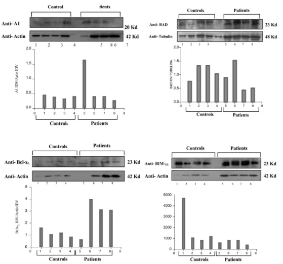 FIGURE S1  - A1, Bcl-x L , Bad, and Bim- EL  protein expression determined in peripheral leukocyte lysates from four PV patients  and four controls