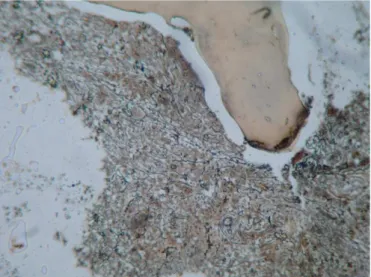 FIGURE 1A  - Histological sections of normal BMB (degree  0) stained by Gomori silver solution, 100 x magniication