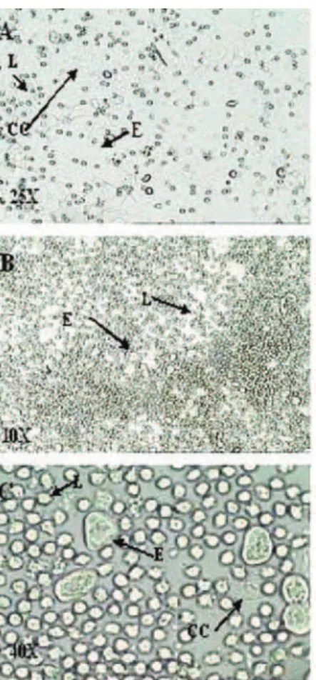 FIGURE 1  - Photomicrographs of unstained native vaginal  smear from rats, observed under a light microscope with 25,  10, and 40X objective lenses, respectively, after administration  of depomedroxyprogesterone acetate 100.0 mg/wk/rat