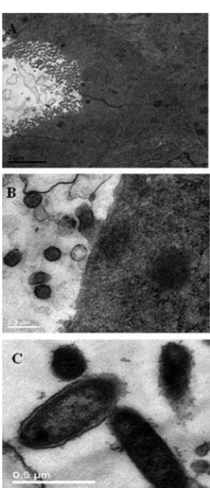 FIGURE 7  - Yeasts and vaginal epithelium of rats observed by  transmission electron microscopy (TEM), after establishment of  diestrus and induced vulvovaginal candidiasis