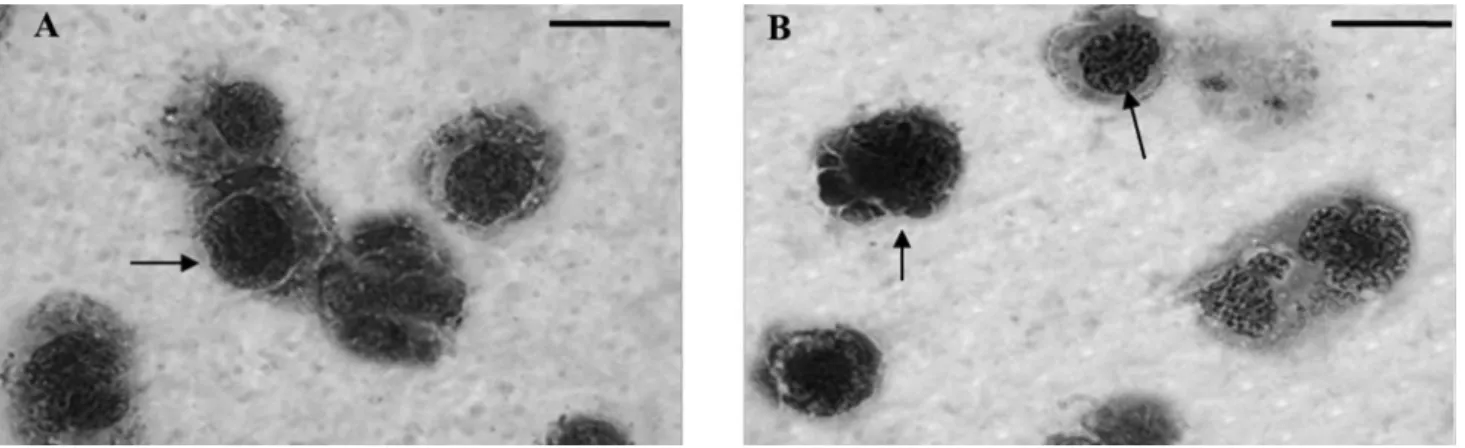 FIGURE 2  - Morphological changes of Synadenium umbellatum-induced apoptosis in K-562 cells