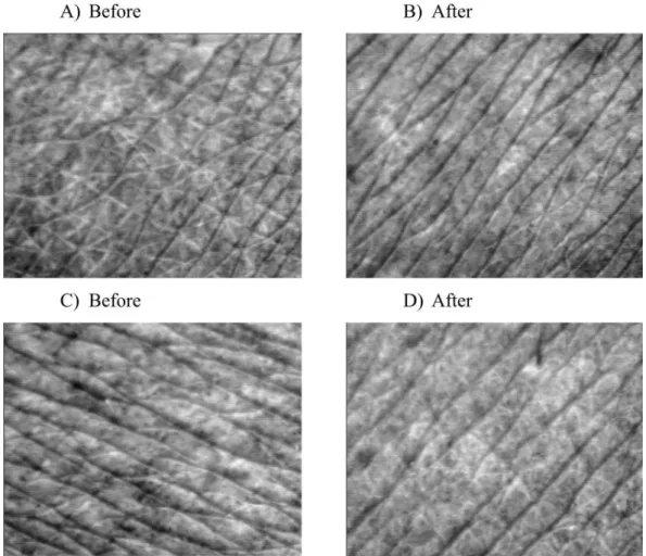 FIGURE 5  -  Skin surface evaluation (skin micro-relief). Surface of the skin of a volunteer who applied formulation B before  (A)  and after (B) 30 days of application and of a volunteer who applied formulation C before (C) and after (D) 30 days of applic