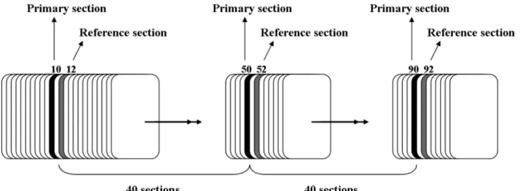 FIGURE 2  - Point counting grade (A) and unbiased counting  frame (B).
