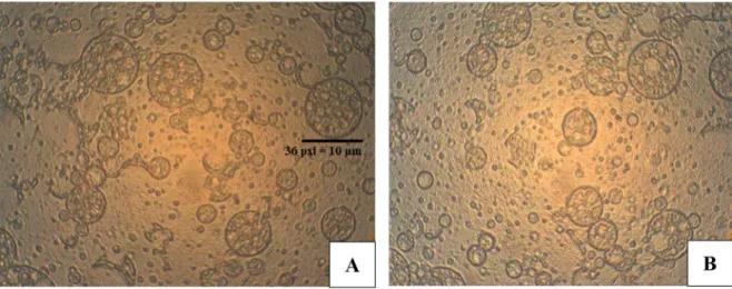 FIGURE 1  -  Photomicrographs of multiple emulsions. A = Fresh sample MeA, B = Fresh sample MeB.