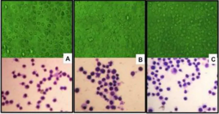 FIGURE 6  – K-562 cells at 24 h of exposure. Top row: living  cells. Bottom row: cells ixed and stained with Giemsa after test  completion