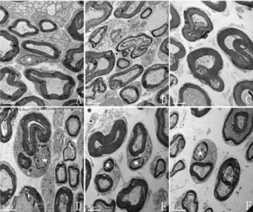 FIGURE 8  - Electron microscopy of Fresh-, TMP-, and UW- UW-nerve cross-sections after four weeks of preservation