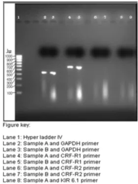 FIGURE 2  – Effect of different concentrations of hydrogen  peroxide on ND7/23 cells survival.