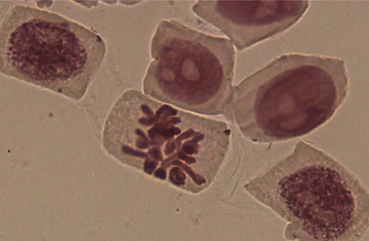 FIGURE 2  - Micronucleus in interphase.