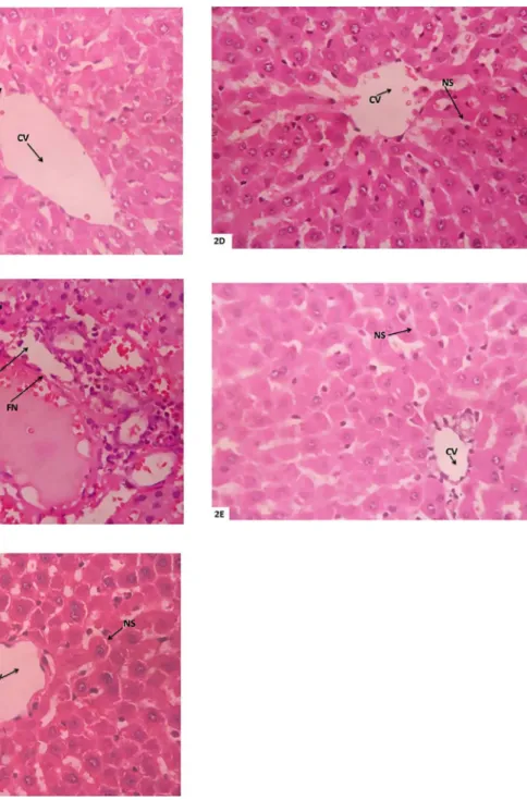 FIGURE 2  - A - Liver normal control; B-Diabetic control; C-Standard (glimepiride); D-Alcohol extract (100 mg/kg); E-Alcohol  extract (200 mg/kg)