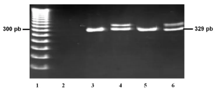 FIGURE 2  - PCR products of FLT3-D835, analyzed by gel  electrophoresis. Reverse view of ethidium-bromide-stained  12% polyacrylamide gel FLT3-D835 was detected as  extra-band after enzymatic digestion in addition to normal extra-bands of  68 bp and 46 bp
