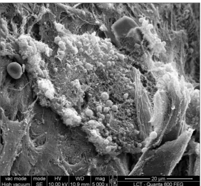 Figure 3. Bacterial biofilm (magnified 12.000x)