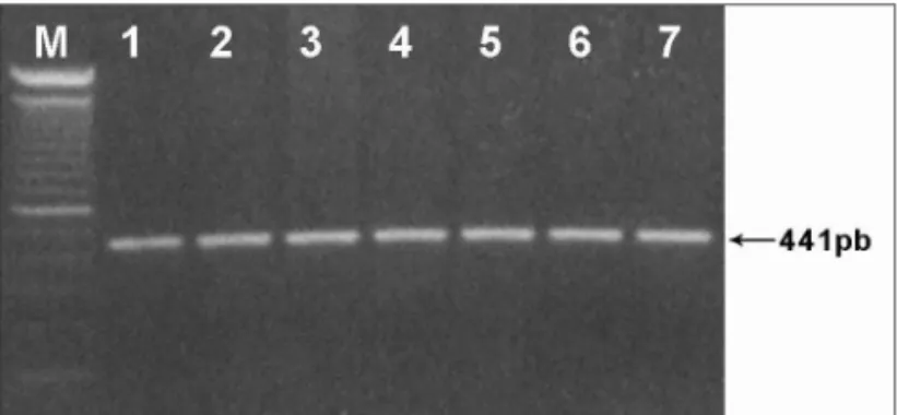 Figure 1. 441pb fragment from gene 12S rRNA amplified by PCR and  analyzed in 1% agarose gel (M) - molecular weight marker (100pb).