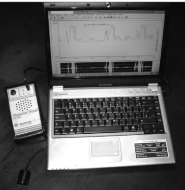 Figure 2. Doppler sonar coupled to a notebook computer