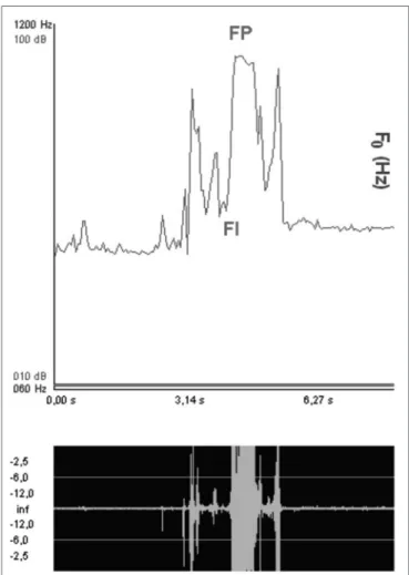 Figure 4. Sound wave peak and initial frequencies